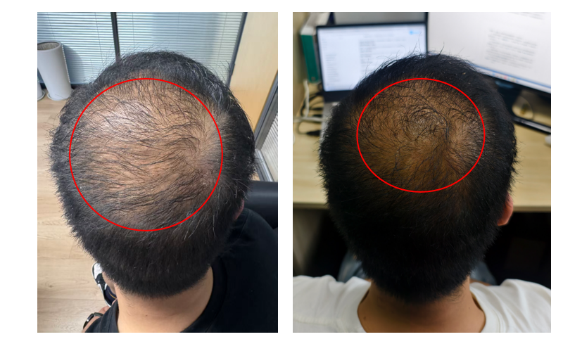 Before/after human use