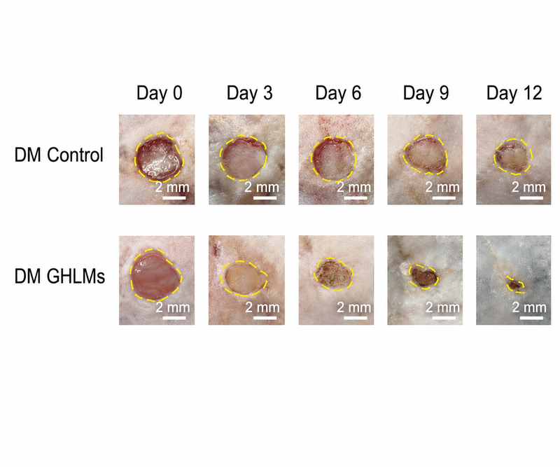 Day 0-12 wound healing